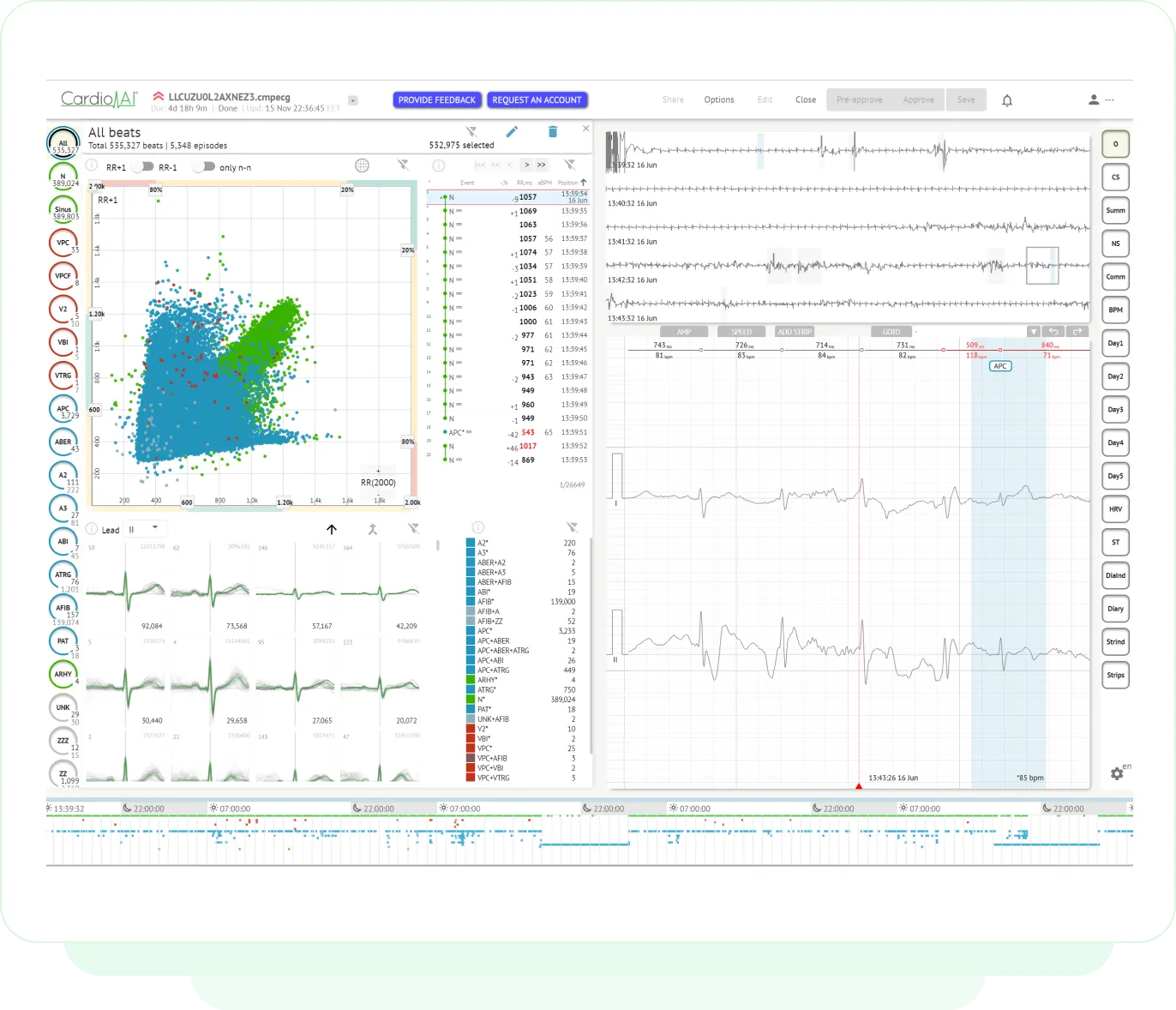 State-of-the-art ECG analytics technology